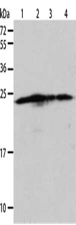 Gel: 12%SDS-PAGE, Lysate: 40 μg, Lane 1-4: Hela cells, A431 cells, 293T cells, Jurkat cells, Primary antibody: BAK1 Antibody(BAK1 Antibody) at dilution 1/900, Secondary antibody: Goat anti rabbit IgG at 1/8000 dilution, Exposure time: 5 seconds