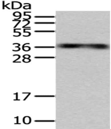 Gel: 12%SDS-PAGE,Lysate: 40 μg,,Primary antibody: MSI1 Antibody(MSI1 Antibody) at dilution 1/200 dilution,Secondary antibody: Goat anti rabbit IgG at 1/8000 dilution,Exposure time: 5 minutesRabbit anti-Human MSI1 Polyclonal Antibody
