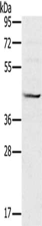 Gel: 8%SDS-PAGE, Lysate: 40 μg, Lane: Raji cells, Primary antibody: MVK Antibody(MVK Antibody) at dilution 1/550, Secondary antibody: Goat anti rabbit IgG at 1/8000 dilution, Exposure time: 2 secondsRabbit anti-Human MVK Polyclonal Antibody