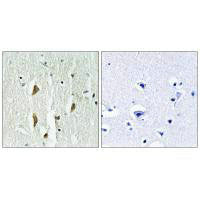 Immunohistochemistry analysis of paraffin-embedded human brain tissue using PAK1/2/3 (Ab-423/402/421) antiobdy.Rabbit anti-Human PAK1/PAK2/PAK3 Polyclonal Antibody