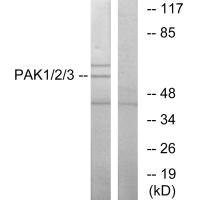 Western blot analysis of extracts from NIH-3T3 cells, using PAK1/2/3 (Ab-423/402/421) antibody.Rabbit anti-Human PAK1/PAK2/PAK3 Polyclonal Antibody
