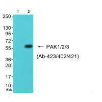 Western blot analysis of extracts from 293 cells (Lane 2), using PAK1/2/3 (Ab-423/402/421) antiobdy. The lane on the left is treated with synthesized peptide.Rabbit anti-Human PAK1/PAK2/PAK3 Polyclonal Antibody