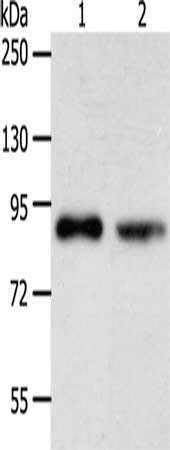 Gel: 10%SDS-PAGE, Lysate: 40 μg, Lane 1-2: SKOV3 cells, K562 cells, Primary antibody: APPL1 Antibody(APPL1 Antibody) at dilution 1/275, Secondary antibody: Goat anti rabbit IgG at 1/8000 dilution, Exposure time: 3 minutes