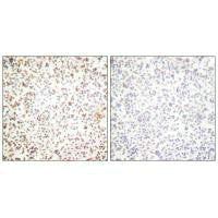 Immunohistochemical analysis of paraffin-embedded human lymph node tissue using OCT-1 antibody.Rabbit anti-Human POU2F1 Polyclonal Antibody