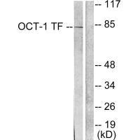 Western blot analysis of extracts from HeLa cells, using OCT-1 antibody.Rabbit anti-Human POU2F1 Polyclonal Antibody