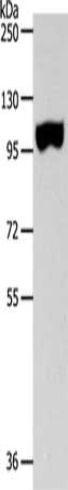 Gel: 8%SDS-PAGE, Lysate: 40 μg, Lane: Human colon tissue, Primary antibody: SPAG1 Antibody(SPAG1 Antibody) at dilution 1/600, Secondary antibody: Goat anti rabbit IgG at 1/8000 dilution, Exposure time: 2 minutesRabbit anti-Human SPAG1 Polyclonal Antibody