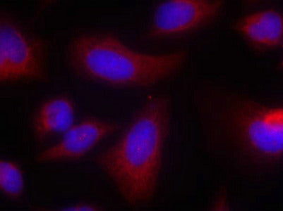 Immunofluorescence staining of methanol-fixed Hela cells using p70 S6 Kinase(Ab-424) Antibody.Rabbit anti-Human RPS6KB1 Polyclonal Antibody