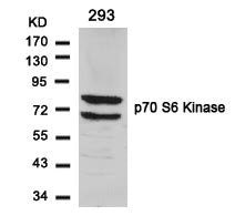 Western blot analysis of extracts from 293 cells using p70 S6 Kinase(Ab-424) Antibody.Rabbit anti-Human RPS6KB1 Polyclonal Antibody