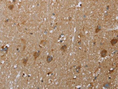 The image on the left is immunohistochemistry of paraffin-embedded Human brain tissue using the antibody Antibody) at dilution 1/50, on the right is treated with fusion protein. (Original magnification: ×200)Rabbit anti-Human COX6B2 Polyclonal Antibody