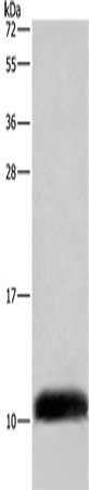 Gel: 10%SDS-PAGE, Lysate: 40 μg, Lane: A549 cells, Primary antibody: COX6B2 Antibody(COX6B2 Antibody) at dilution 1/500, Secondary antibody: Goat anti rabbit IgG at 1/8000 dilution, Exposure time: 5 secondsRabbit anti-Human COX6B2 Polyclonal Antibody