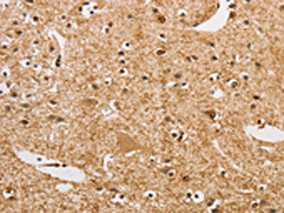 The image on the left is immunohistochemistry of paraffin-embedded Human brain  tissue using ARHGEF5 Antibody(ARHGEF5 Antibody) at dilution 1/50, on the right is treated with fusion protein. (Original magnification: ×200)Rabbit anti-Human ARHGEF5 Polyclonal Antibody