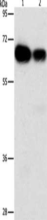 Gel: 8%SDS-PAGE, Lysate: 40 μg, Lane 1-2: Hela cells, K562 cells, Primary antibody: ARHGEF5 Antibody(ARHGEF5 Antibody) at dilution 1/1150, Secondary antibody: Goat anti rabbit IgG at 1/8000 dilution, Exposure time: 1 minuteRabbit anti-Human ARHGEF5 Polyclonal Antibody