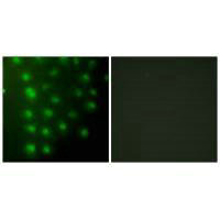 Immunofluorescence analysis of HUVEC cells, using AKAP8 antibody.Rabbit anti-Human AKAP8 Polyclonal Antibody