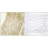 Immunohistochemistry analysis of paraffin-embedded human heart tissue using AKAP8 antibody.Rabbit anti-Human AKAP8 Polyclonal Antibody