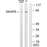 Western blot analysis of extracts from mouse heart cells and Jurkat cells, using AKAP8 antibody.Rabbit anti-Human AKAP8 Polyclonal Antibody