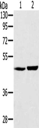 Gel: 8%SDS-PAGE, Lysate: 40 μg, Lane 1-2: Human fetal liver tissue, mouse liver tissue, Primary antibody: SEC14L2 Antibody(SEC14L2 Antibody) at dilution 1/300, Secondary antibody: Goat anti rabbit IgG at 1/8000 dilution, Exposure time: 5 minutesRabbit anti-Human SEC14L2 Polyclonal Antibody