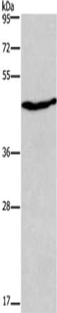 Gel: 8%SDS-PAGE,Lysate: 40 μg,,Primary antibody: CCR8 Antibody(CCR8 Antibody) at dilution 1/350 dilution,Secondary antibody: Goat anti rabbit IgG at 1/8000 dilution,Exposure time: 20 secondsRabbit anti-Human CCR8 Polyclonal Antibody