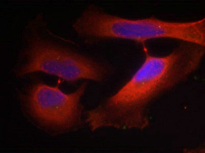 Immunofluorescence staining of methanol-fixed Hela cells using Keratin 8(Phospho-Ser74) Antibody.