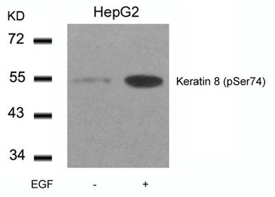 Western blot analysis of extracts from HepG2 cells untreated or treated with EGF using Keratin 8(Phospho-Ser74) Antibody.