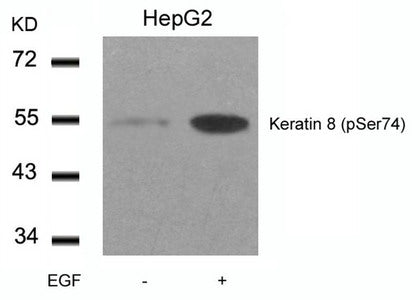 Western blot analysis of extracts from HepG2 cells untreated or treated with EGF using Keratin 8(Phospho-Ser74) Antibody.