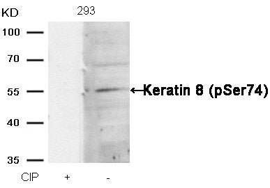 Western blot analysis of extracts from 293 cells, treated with calf intestinal phosphatase (CIP), using Keratin 8 (Phospho-Ser74) Antibody.