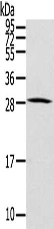 Gel: 12%SDS-PAGE, Lysate: 40 μg, Lane: Human thyroid cancer tissue, Primary antibody: HOXC8 Antibody(HOXC8 Antibody) at dilution 1/200, Secondary antibody: Goat anti rabbit IgG at 1/8000 dilution, Exposure time: 10 secondsRabbit anti-Human HOXC8 Polyclonal Antibody