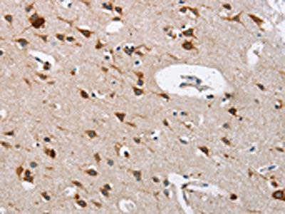 The image on the left is immunohistochemistry of paraffin-embedded Human brain tissue using the antibody Antibody) at dilution 1/40, on the right is treated with fusion protein. (Original magnification: ×200)Rabbit anti-Human CTSL Polyclonal Antibody