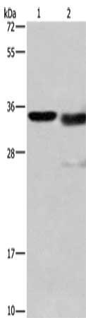 Gel: 15%SDS-PAGE, Lysate: 40 μg, Lane 1-2: Mouse kidney tissue, A172 cells, Primary antibody: CTSL Antibody(CTSL Antibody) at dilution 1/900, Secondary antibody: Goat anti rabbit IgG at 1/8000 dilution, Exposure time: 10 secondsRabbit anti-Human CTSL Polyclonal Antibody