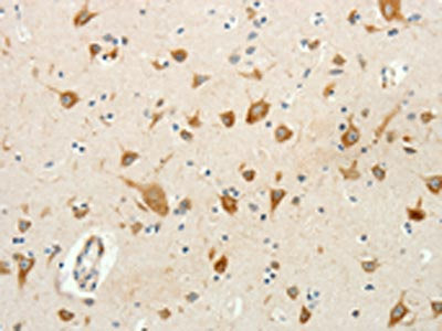 The image on the left is immunohistochemistry of paraffin-embedded Human brain tissue using the antibody Antibody) at dilution 1/20, on the right is treated with fusion protein. (Original magnification: ×200)Rabbit anti-Human RPAP3 Polyclonal Antibody