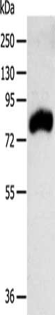 Gel: 10%SDS-PAGE, Lysate: 40 μg, Lane: Mouse kidney tissue, Primary antibody: RPAP3 Antibody(RPAP3 Antibody) at dilution 1/400, Secondary antibody: Goat anti rabbit IgG at 1/8000 dilution, Exposure time: 1 minuteRabbit anti-Human RPAP3 Polyclonal Antibody