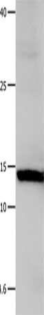 Gel: 12+15%SDS-PAGE, Lysate: 40 μg, Lane: Hela cells, Primary antibody: LGALS1 Antibody(LGALS1 Antibody) at dilution 1/500, Secondary antibody: Goat anti rabbit IgG at 1/8000 dilution, Exposure time: 10 seconds