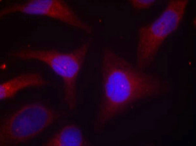 Immunofluorescence staining of methanol-fixed Hela cells using IkB-a(Phospho-Ser32/Ser36) Antibody.Rabbit anti-Human NFKBIA Polyclonal Antibody