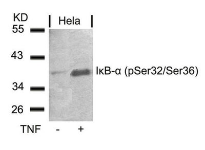 Western blot analysis of extracts from Hela cells untreated or treated with TNF using IkB-a(Phospho-Ser32/Ser36) Antibody.Rabbit anti-Human NFKBIA Polyclonal Antibody