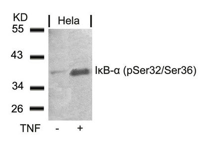 Western blot analysis of extracts from Hela cells untreated or treated with TNF using IkB-a(Phospho-Ser32/Ser36) Antibody.Rabbit anti-Human NFKBIA Polyclonal Antibody