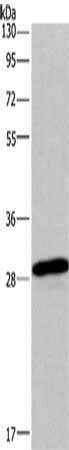 Gel: 10%SDS-PAGE, Lysate: 40 μg, Lane: mouse brain tissue, Primary antibody: BNIP3 Antibody(BNIP3 Antibody) at dilution 1/275, Secondary antibody: Goat anti rabbit IgG at 1/8000 dilution, Exposure time: 20 seconds
