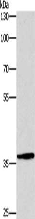Gel: 8%SDS-PAGE, Lysate: 40 μg, Lane: Hela cells, Primary antibody: DUSP2 Antibody(DUSP2 Antibody) at dilution 1/300, Secondary antibody: Goat anti rabbit IgG at 1/8000 dilution, Exposure time: 1 minuteRabbit anti-Human DUSP2 Polyclonal Antibody