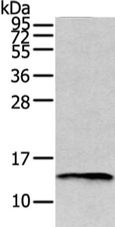 Gel: 12%SDS-PAGE, Lysate: 40 μg, Lane: Mouse fat tissue, Primary antibody: PMP2 Antibody(PMP2 Antibody) at dilution 1/400 dilution, Secondary antibody: Goat anti rabbit IgG at 1/8000 dilution, Exposure time: 80 secondsRabbit anti-Human PMP2 Polyclonal Antibody