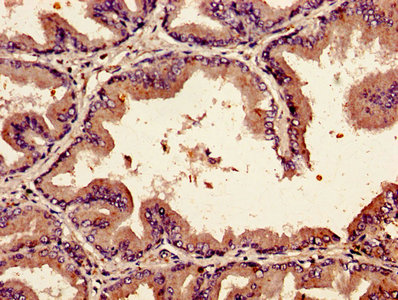 Immunohistochemistry of paraffin-embedded human prostate tissue using the antibody at dilution of 1:100