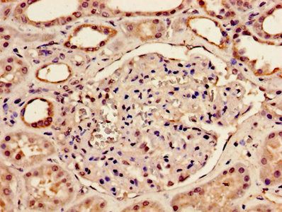 Immunohistochemistry of paraffin-embedded human kidney tissue using BMP2 Antibody at dilution of 1:100