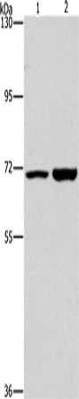 Gel: 6%SDS-PAGE, Lysate: 40 μg, Lane 1-2: PC3 cells, 293T cells, Primary antibody: PIP5K1A Antibody(PIP5K1A Antibody) at dilution 1/300, Secondary antibody: Goat anti rabbit IgG at 1/8000 dilution, Exposure time: 40 secondsRabbit anti-Human PIP5K1A Polyclonal Antibody