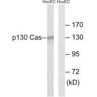 Western blot analysis of extracts from NIH/3T3 cells, using p130 Cas (Ab-410) antibody.