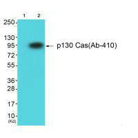 Western blot analysis of extracts from HuvEc cells using p130 Cas (Ab-410) antibody. The lane on the left is treated with synthesized peptide.