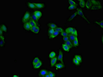 Immunofluorescent analysis of HepG2 cells using CD36 Antibody at dilution of 1:100 and Alexa Fluor 488-congugated AffiniPure Goat Anti-Rabbit IgG(H+L)Rabbit anti-Human CD36 Polyclonal Antibody