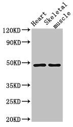Western Blot | Positive WB detected in: Mouse heart tissue, Mouse skeletal muscle tissue | All lanes: CD36 antibody at 2μg/ml | Secondary | Goat polyclonal to rabbit IgG at 1/50000 dilution | Predicted band size: 54, 33, 49, 47 kDa | Observed band size: 49 kDaRabbit anti-Human CD36 Polyclonal Antibody