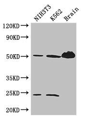 Western Blot | Positive WB detected in: NIH/3T3 whole cell lysate, K562 whole cell lysate, Mouse brain tissue | All lanes: TUBA4A antibody at 3μg/ml | Secondary | Goat polyclonal to rabbit IgG at 1/50000 dilution | Predicted band size: 50, 49 kDa | Observed band size: 50, 24 kDaRabbit anti-Human TUBA4A Polyclonal Antibody