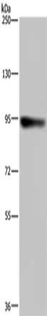 Gel: 6%SDS-PAGE, Lysate: 40 μg, Lane: Hela cells, Primary antibody: PDE4D Antibody(PDE4D Antibody) at dilution 1/200, Secondary antibody: Goat anti rabbit IgG at 1/8000 dilution, Exposure time: 1 minuteRabbit anti-Human PDE4D Polyclonal Antibody