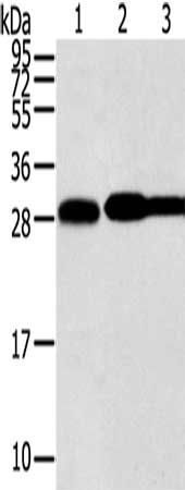 Gel: 12%SDS-PAGE, Lysate: 40 μg, Lane 1-3: Hela cells, lovo cells, A431 cells, Primary antibody: STX10 Antibody(STX10 Antibody) at dilution 1/800, Secondary antibody: Goat anti rabbit IgG at 1/8000 dilution, Exposure time: 5 secondsRabbit anti-Human STX10 Polyclonal Antibody