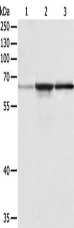 Gel: 10%SDS-PAGE, Lysate: 40 μg, Lane 1-3: A431 cells, human liver cancer tissue, hela cells, Primary antibody: TRAF6 Antibody(TRAF6 Antibody) at dilution 1/250, Secondary antibody: Goat anti rabbit IgG at 1/8000 dilution, Exposure time: 2 minutesRabbit anti-Human TRAF6 Polyclonal Antibody