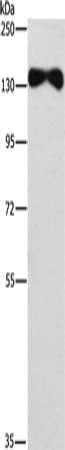 Gel: 6%SDS-PAGE, Lysate: 40 μg, Lane: Human placenta tissue, Primary antibody: EVC2 Antibody(EVC2 Antibody) at dilution 1/450, Secondary antibody: Goat anti rabbit IgG at 1/8000 dilution, Exposure time: 7 minutesRabbit anti-Human EVC2 Polyclonal Antibody