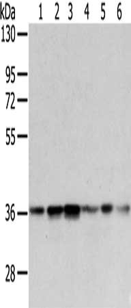 Gel: 8%SDS-PAGE, Lysate: 40 μg, Lane 1-6: A375, 231 and PC3 cell, human lung cancer tissue, hela and NIH/3T3 cell, Primary antibody: WDR5 Antibody(WDR5 Antibody) at dilution 1/300 dilution, Secondary antibody: Goat anti rabbit IgG at 1/8000 dilution, Exposure time: 5 secondsRabbit anti-Human WDR5 Polyclonal Antibody
